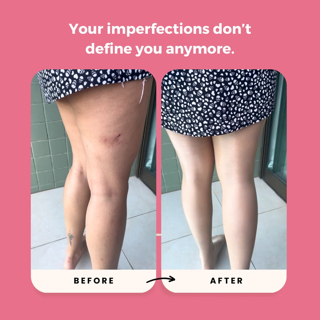 Inviselle™ Anti-Cellulite Tights